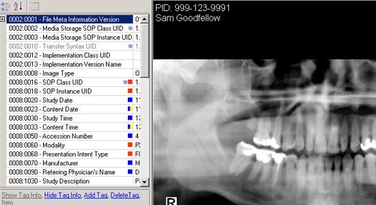 dicom editor screenshot